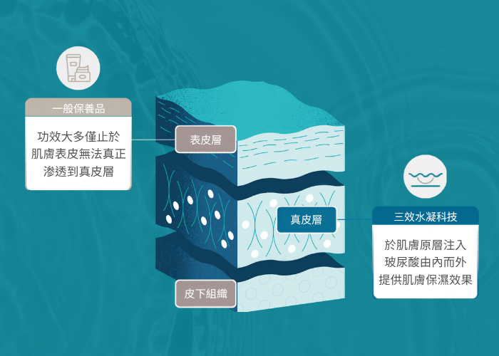 聚光針3