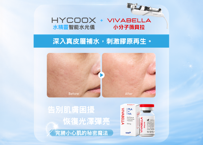 HYCOOX海庫斯5