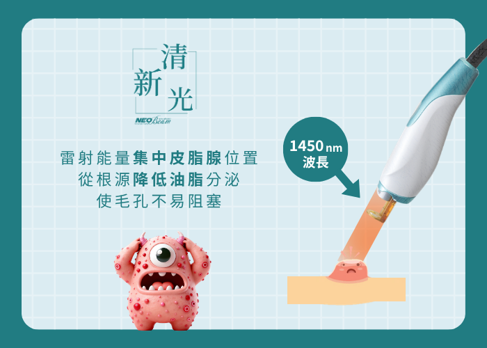 NeoBeam清新光2