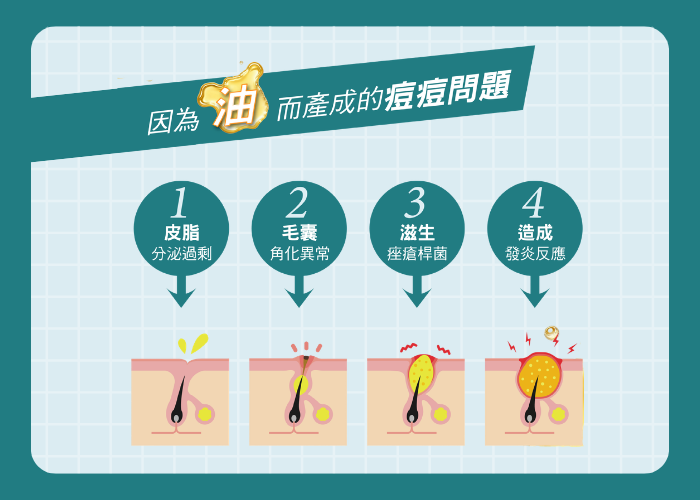 NeoBeam清新光3